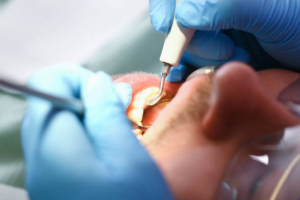 Best Cracked Tooth Emergency Dentist  in Lavon, TX