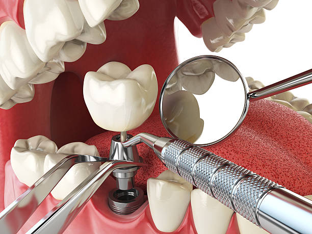 Best Knocked-Out Tooth Emergency  in Lavon, TX